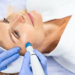 Procedure of microdermabrasion performed by a cosmetician
